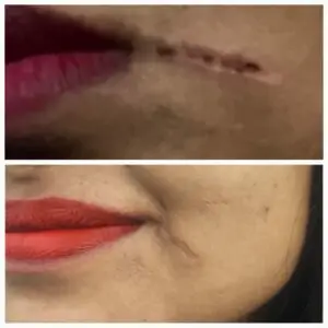 44e23d2e-9e8c-4389-8ea0-35e5ef76229b 44e23d2e-9e8c-4389-8ea0-35e5ef76229b