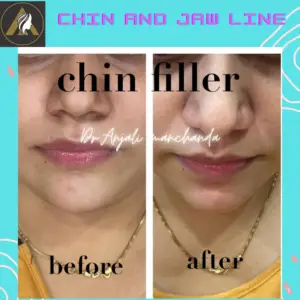 4DDF2446-1DDD-427D-B411-915832A96372 4DDF2446-1DDD-427D-B411-915832A96372