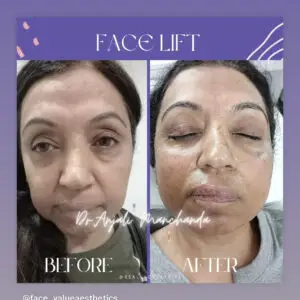 37D3AF7A-BDB4-4FFB-BAA5-6F845C5789DE 37D3AF7A-BDB4-4FFB-BAA5-6F845C5789DE